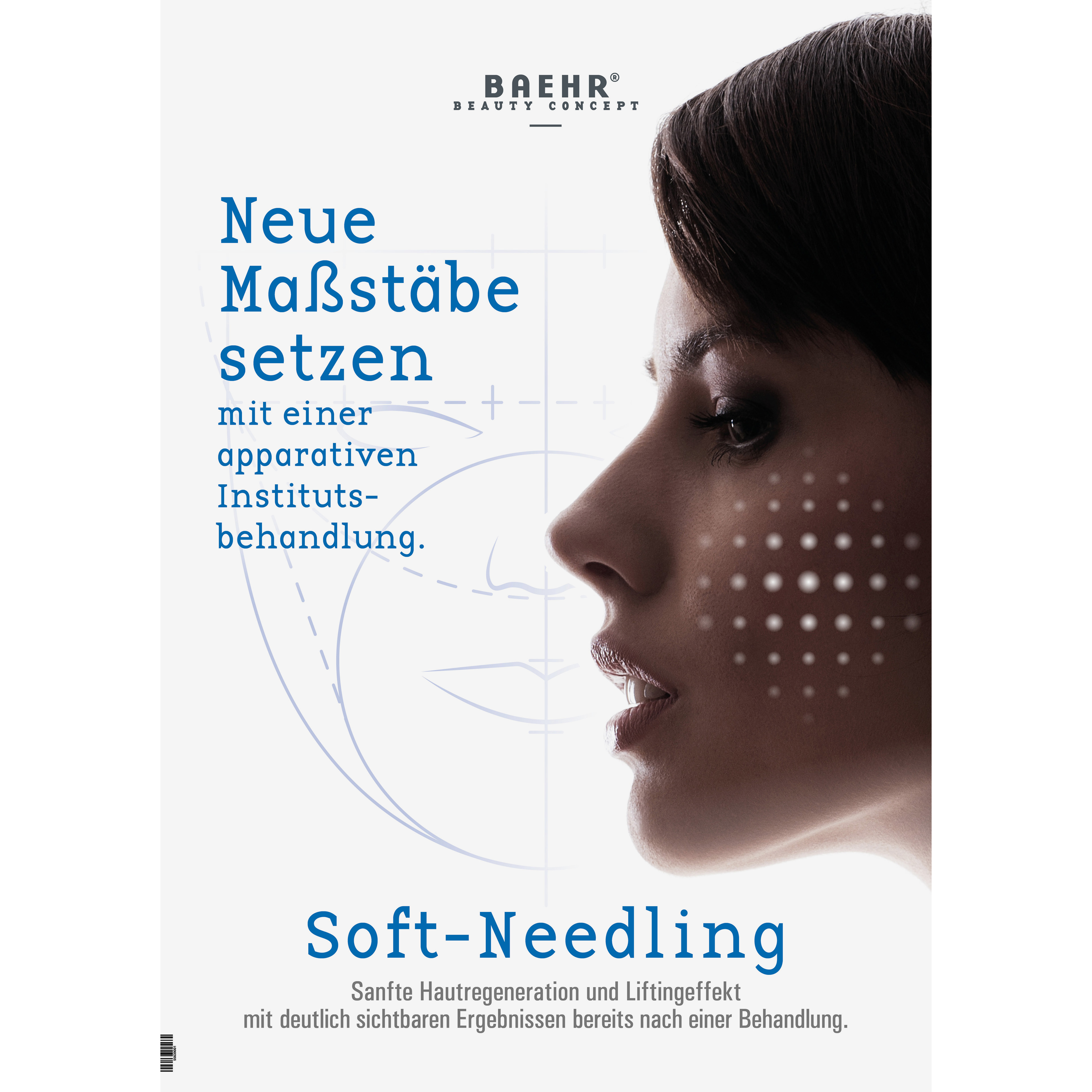 softposter-soft-needling--a1_55639