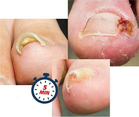5_minuten_553x468